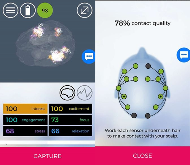 Нейрообследование: фиксация датчиков и проверка сигнала